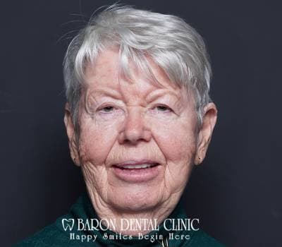 Baron Dental Patient 14