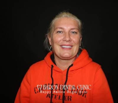 Baron Dental Patient 39