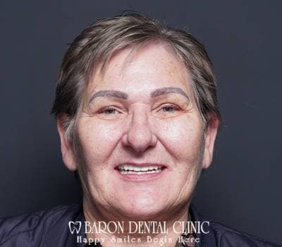 Baron Dental Patient 29