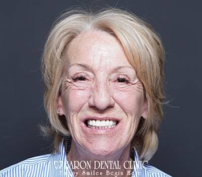 Baron Dental Patient 32