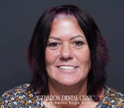 Baron Dental Patient 25