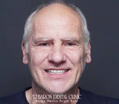 Baron Dental Patient 5