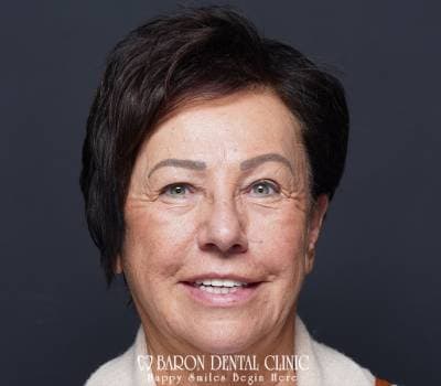 Baron Dental Patient 10