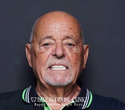 Baron Dental Patient 41